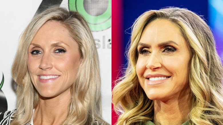 lara trump before and after